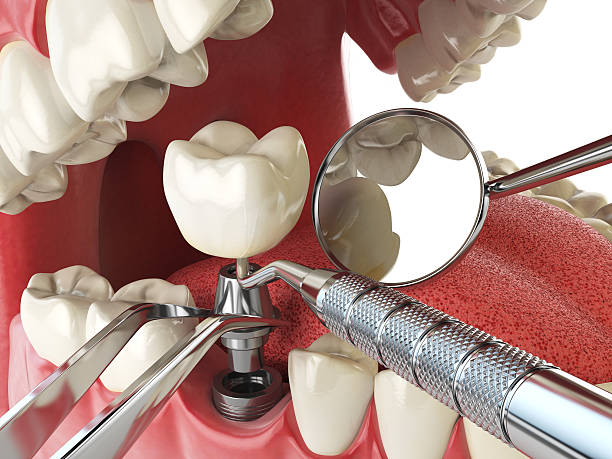 Best Same-Day Emergency Dental Services in North Corbin, KY